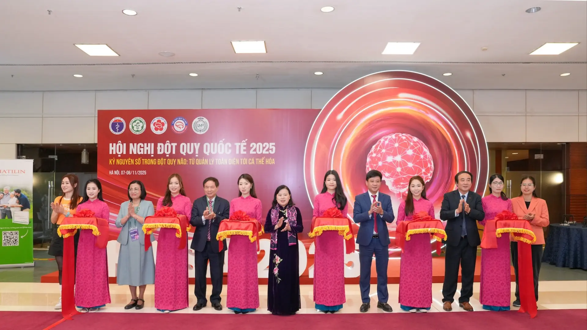 Ứng dụng chuyển đổi số trong điều trị đột quỵ não